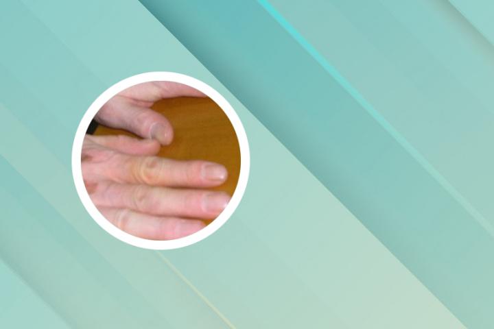 湘潭专业治白癜风医院