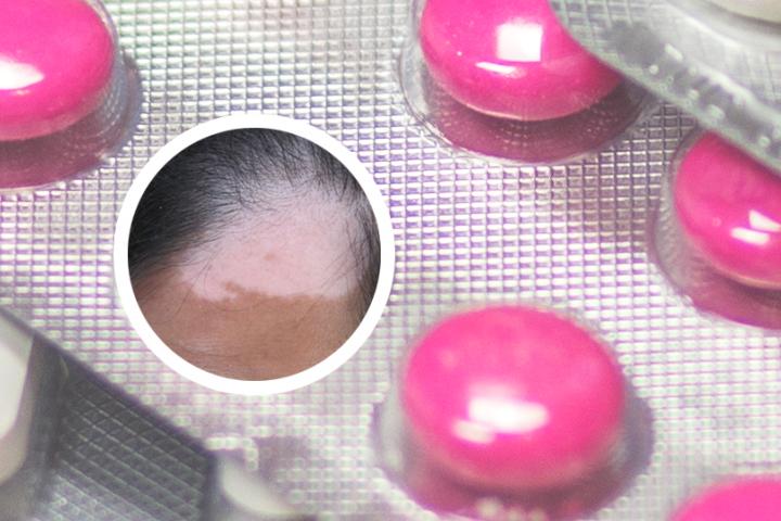 杭州市的白癜风专科医院