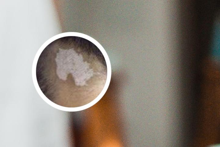 乐山白癜风童学娅仔细