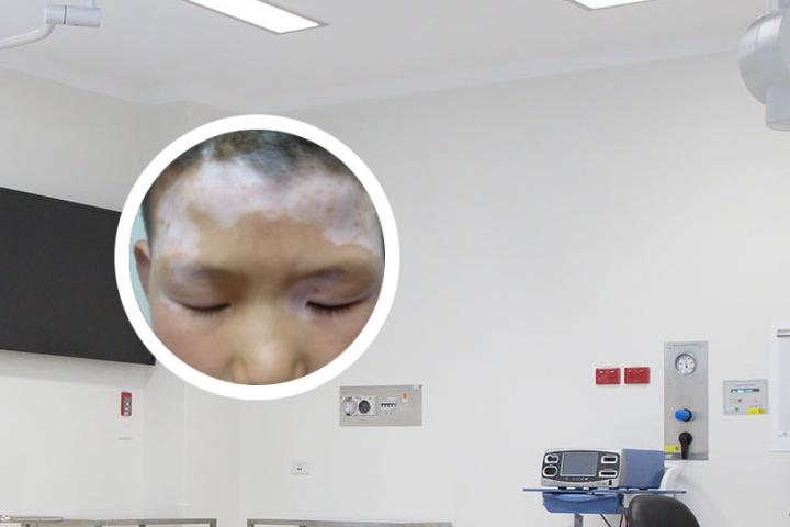 白癜风危害性 白癜风危害科普