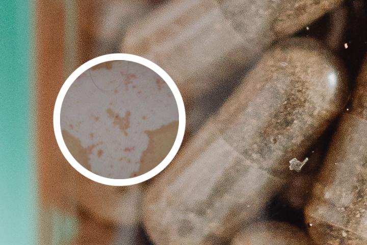 花斑癣跟白癜风有什么不同