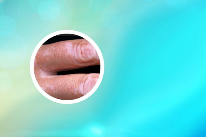 白癜风网上免费专家咨询 白癜风网上免费专家咨询