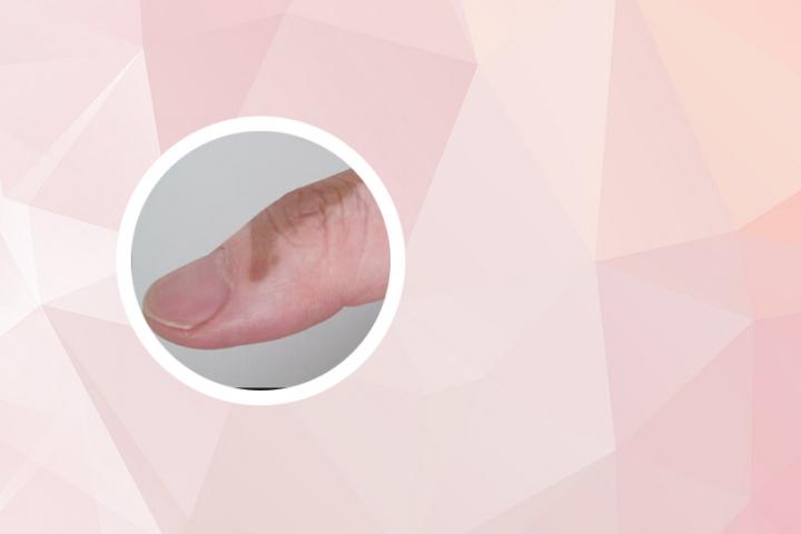 白癜风微量元素化验结果
