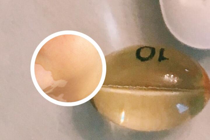 白癜风早期白点的颜色