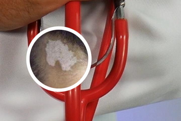兰州白癜风专科医院位置