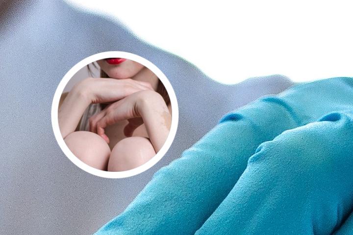 得了白癜风用终身服药吗