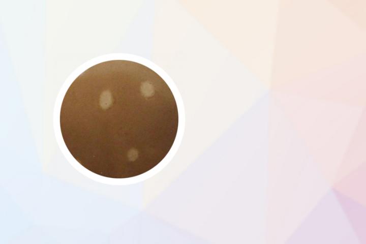 白癜风适合吃白萝卜