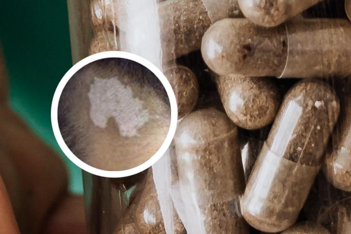 蜂蜜加香油治白癜风