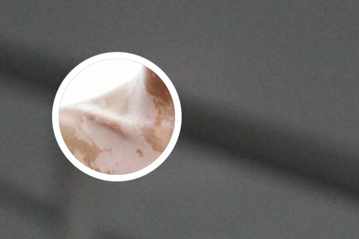 网上卖的白癜风药敢买么