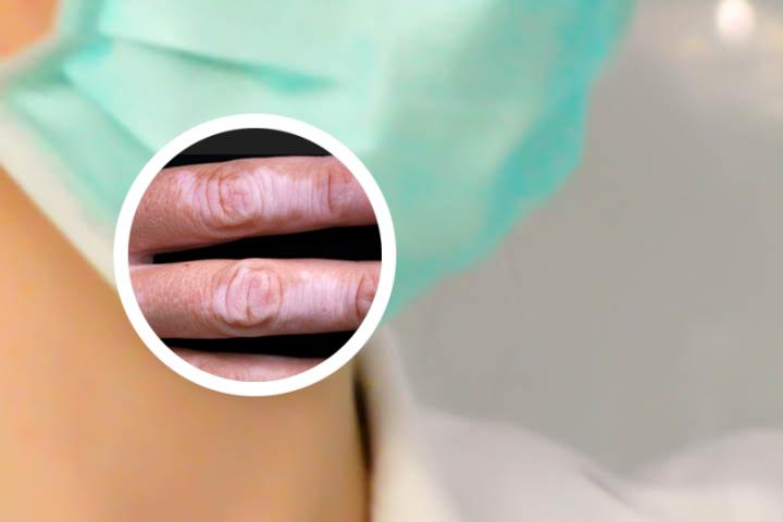白癜风擦拭软膏