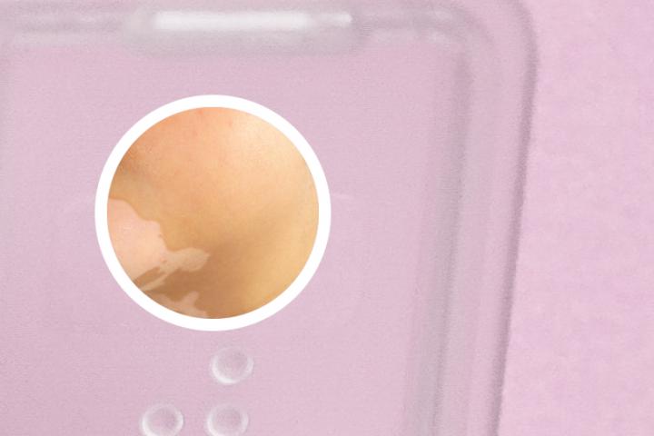 白癜风能否吃梨
