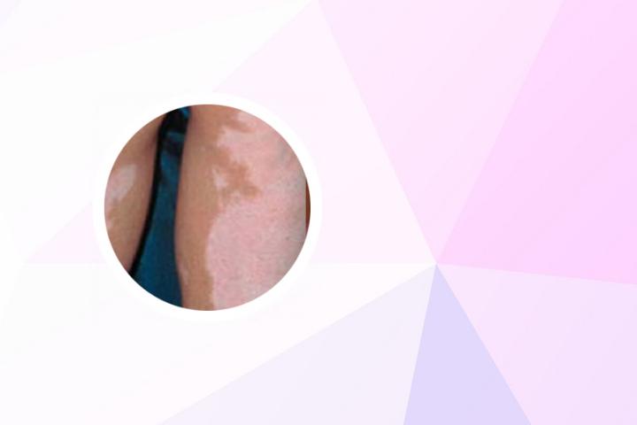 白癜风可以报考什么专业好