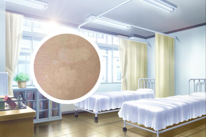 小孩唇部白癜风