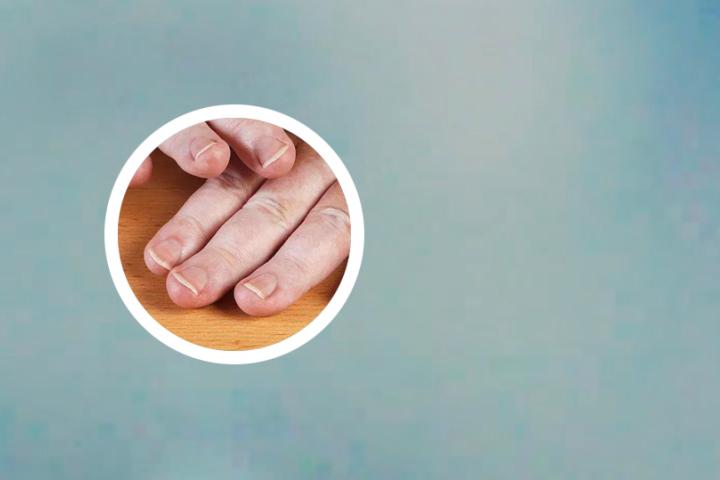白癜风化妆师