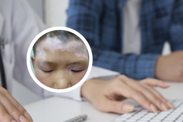 白癜风禁忌白酒吗