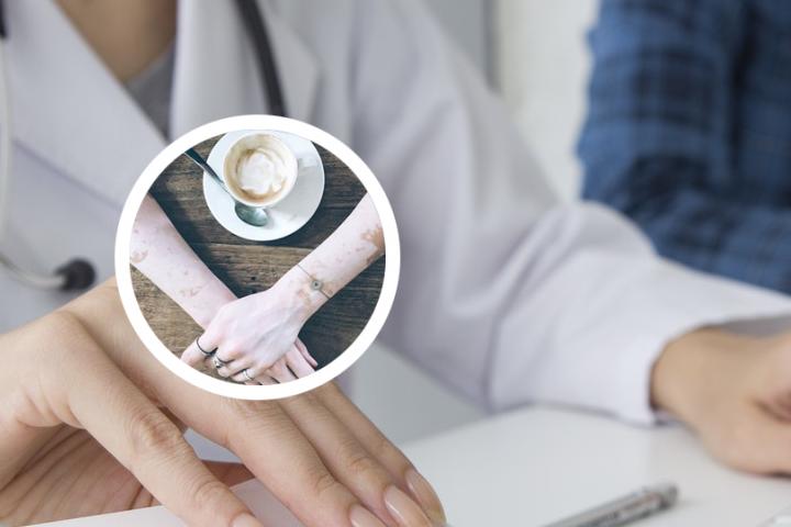 白癜风儿童早期发病图片