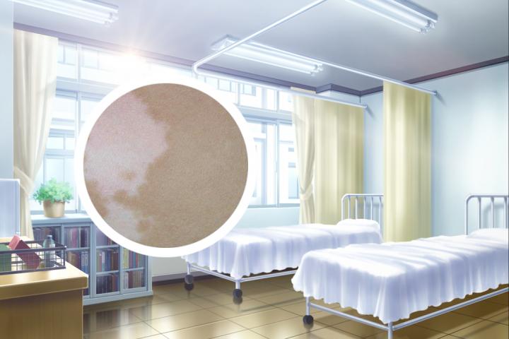 有白癜风能不能吃韭菜
