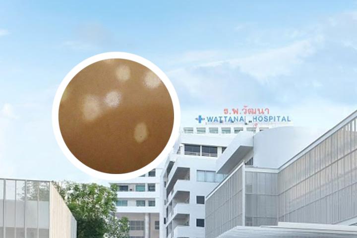 白癜风古籍