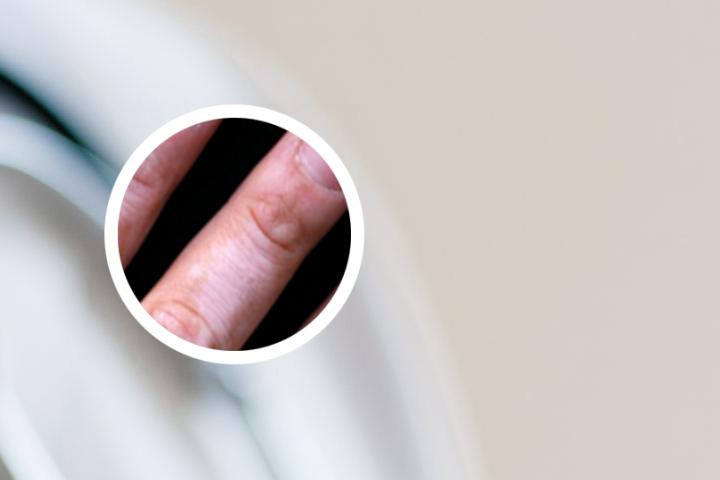 白癜风微量元素检查主要缺什么
