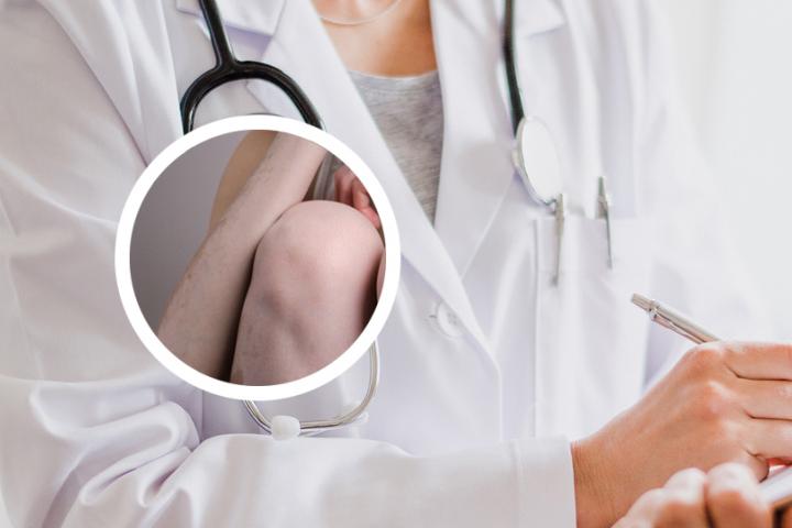 白癜风准分子激光价格