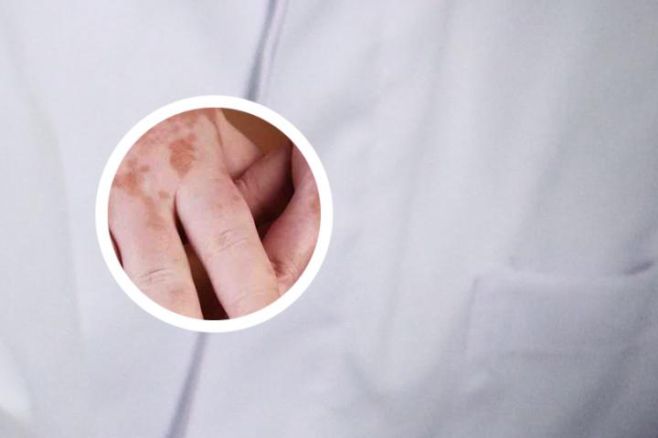 白癜风能吃金针菇么