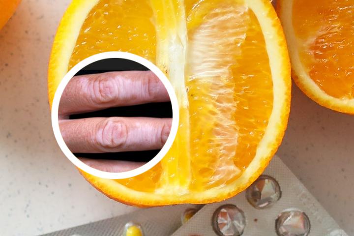 白癜风与铜离子的关系