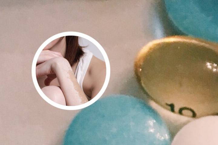 白癜风适应喝啥茶