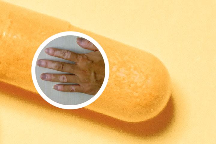 白癜风危害就找戴溱慧