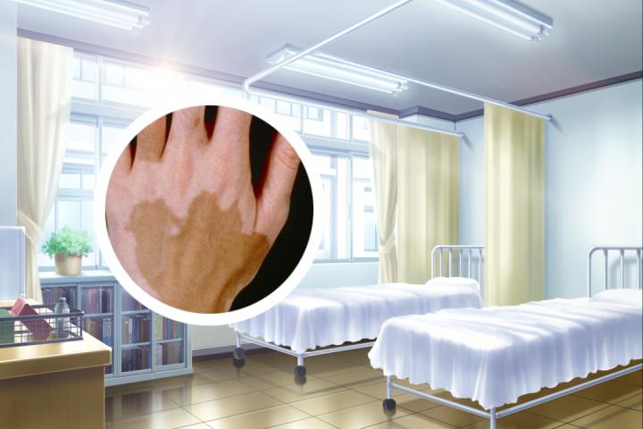 株洲白癜风医院怎么样