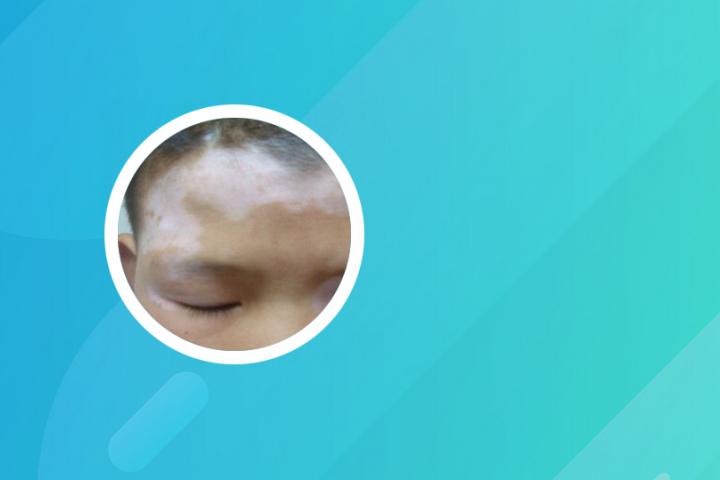 胃不好都会得白癜风吗