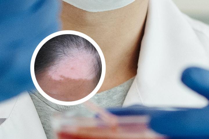 白癜风患者使用的化妆品