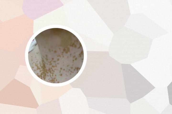有白癜风擦的药膏吗