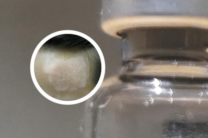白癜风抹药有哪些
