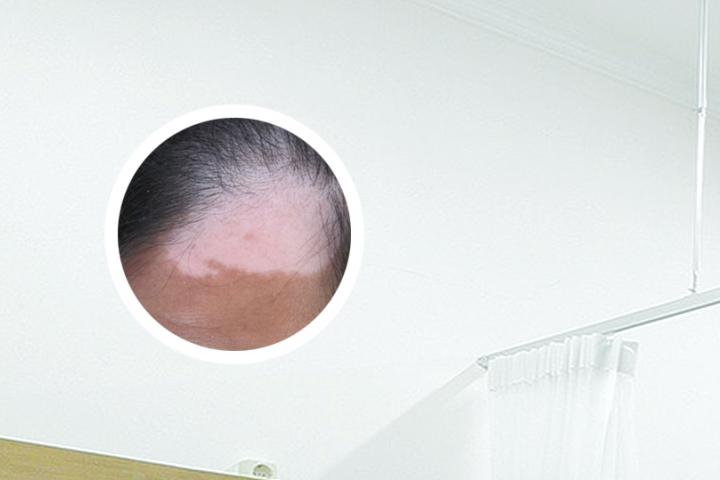 哈尔滨有治白癜风的医院吗
