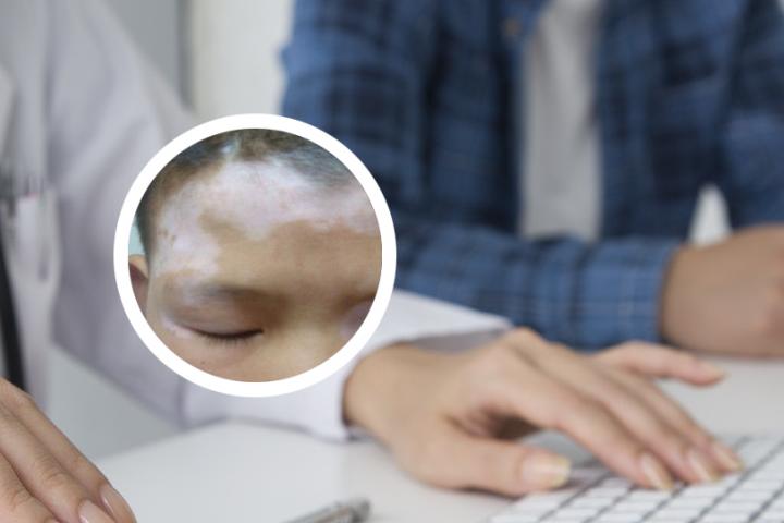 白癜风患者可以吃黄秋葵吗