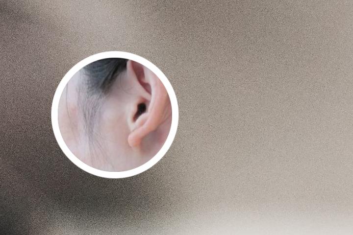 白癜风他克308