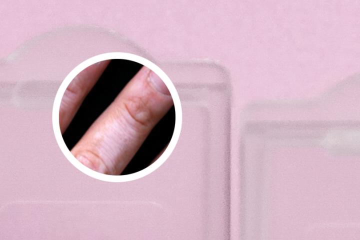 白癜风为啥变粉红色