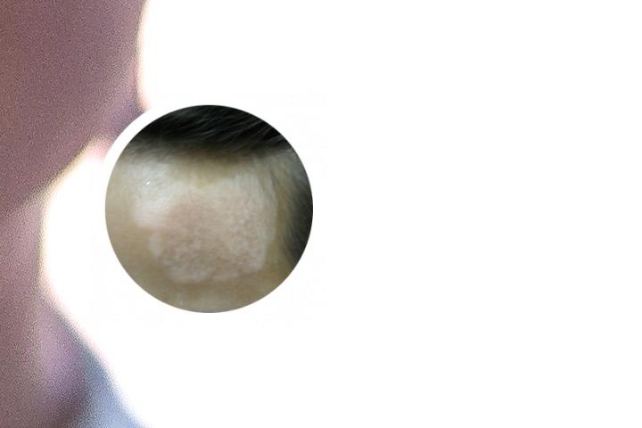 济南治疗白癜风有名的医院