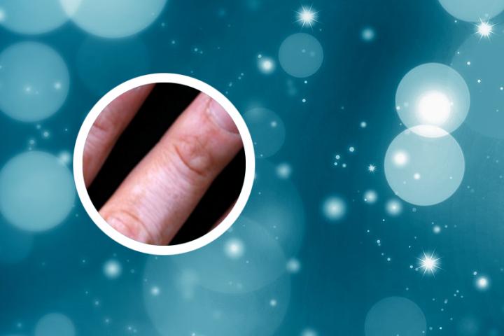 肚子长白癜风