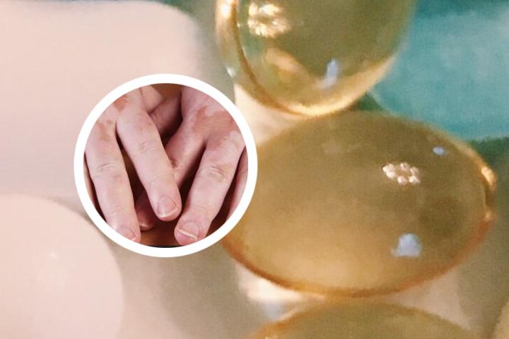 白癜风能吃的蔬菜列表