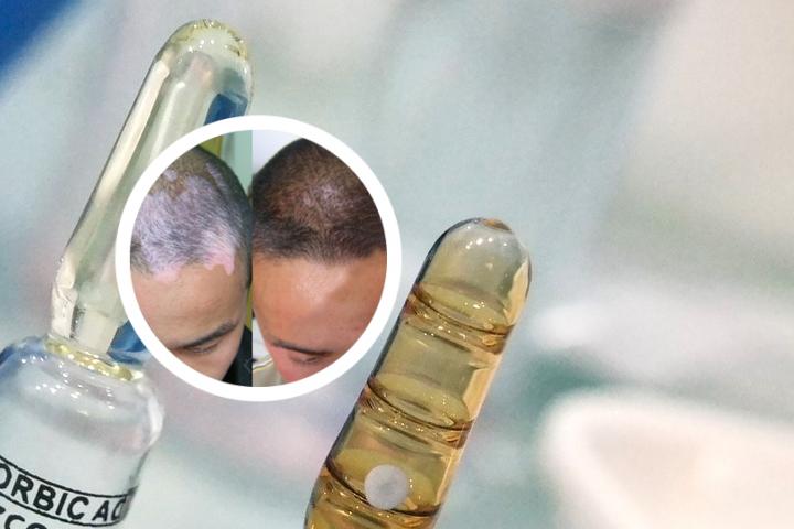 白癜风维克白喷剂