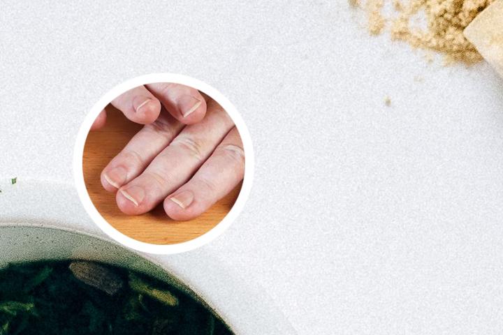 天津白癜风医院周金蓉
