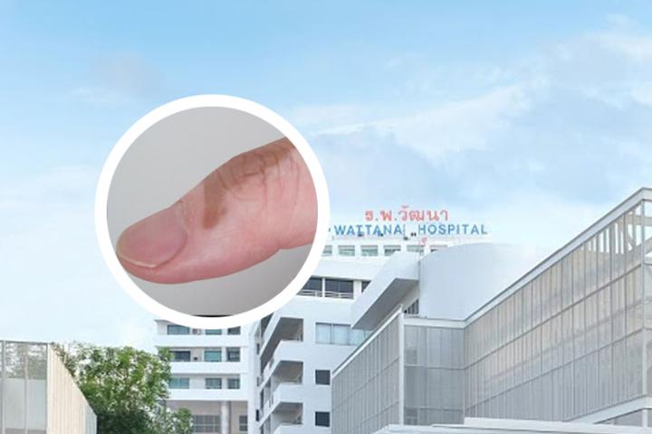 遵义医学院可以看白癜风吗