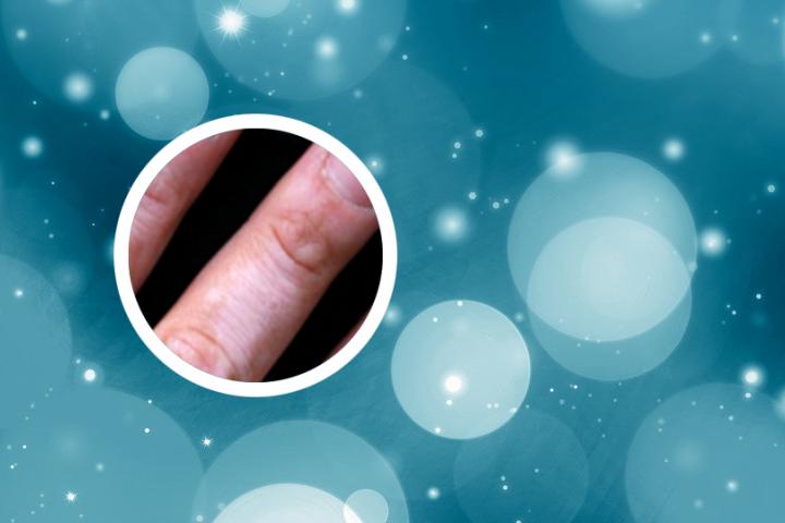 白癜风晚上睡觉怎么治 白癜风晚上睡觉的正确方法