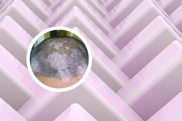 抚顺哪里治白癜风最好