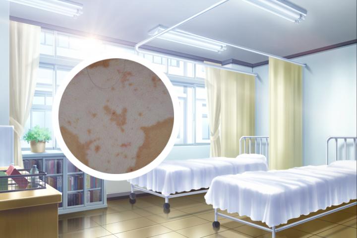白癜风激光多久能治愈