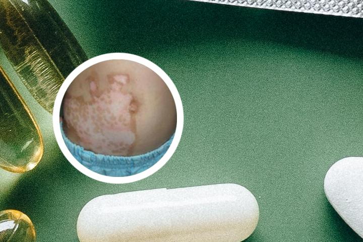 淘宝网治白癜风药膏