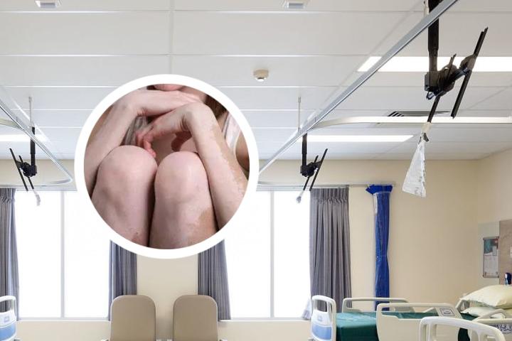 女孩患白癜风遗传吗