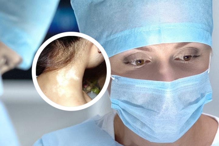 孩子脚上白癜风容易扩散吗
