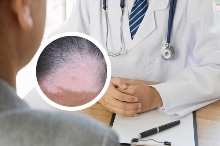 白癜风打针要多少钱
